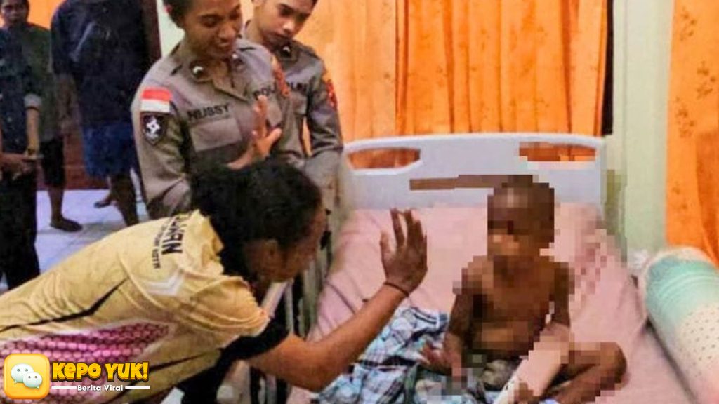 Polri Pastikan Perawatan Anak Korban Kekerasan di Jayapura